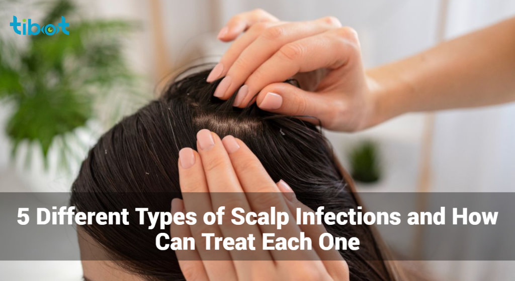 Different Types Of Scalp Infections And How Can Treat Each One