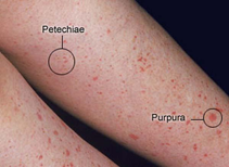 Causes of Red Bumps and Spots on Legs