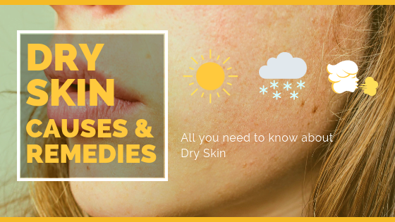 Dry skin is also called xerosis, which is a common skin condition