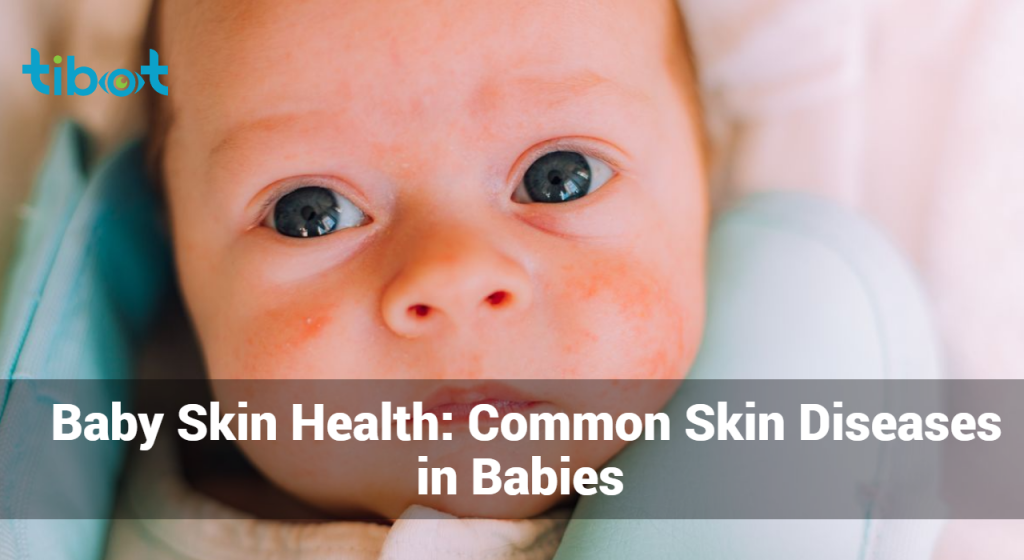 Baby Skin Health: Common Skin Diseases in Babies | Tibot