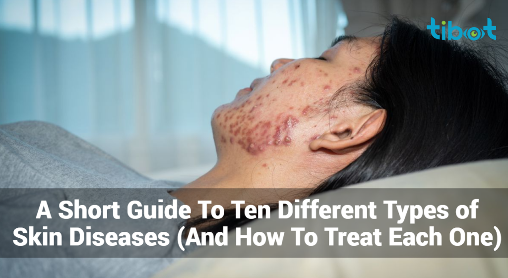 A Short Guide To Ten Different Types of Skin Diseases