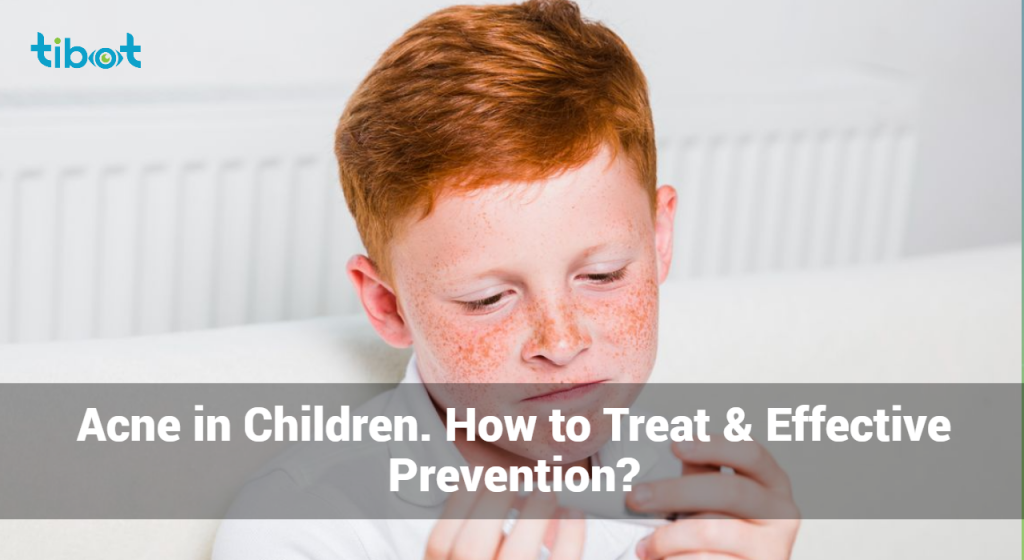 Acne In Children. How To Treat & Effective Prevention?