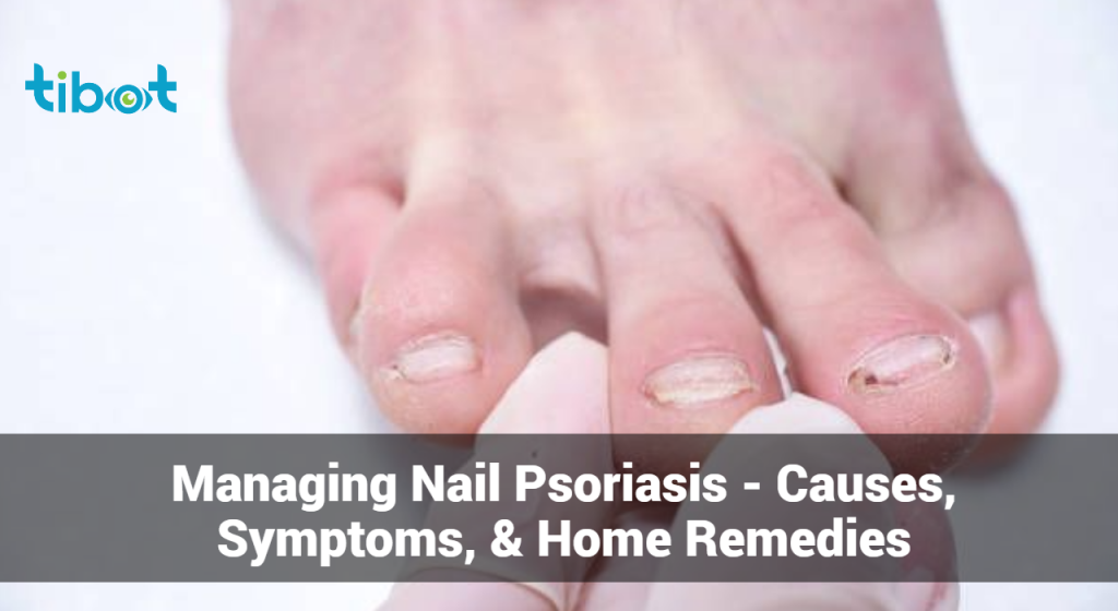 Managing Nail Psoriasis - Causes, Symptoms, & Home Remedies