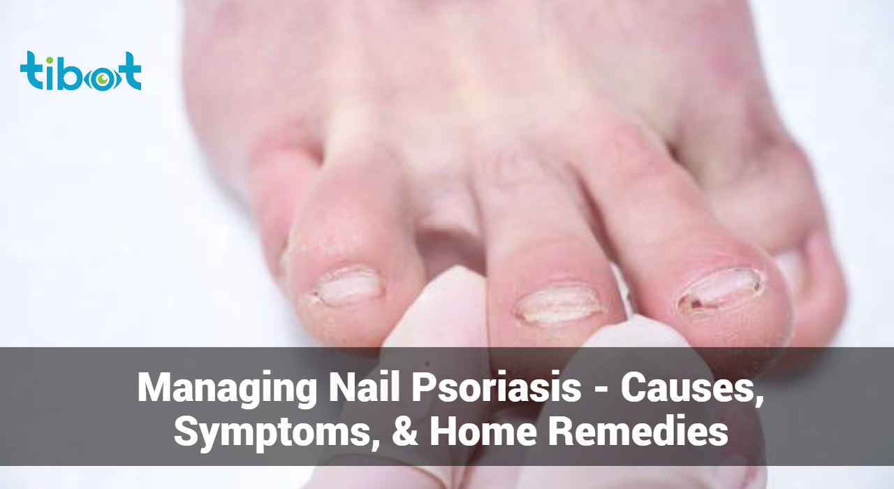 Managing-Nail-Psoriasis