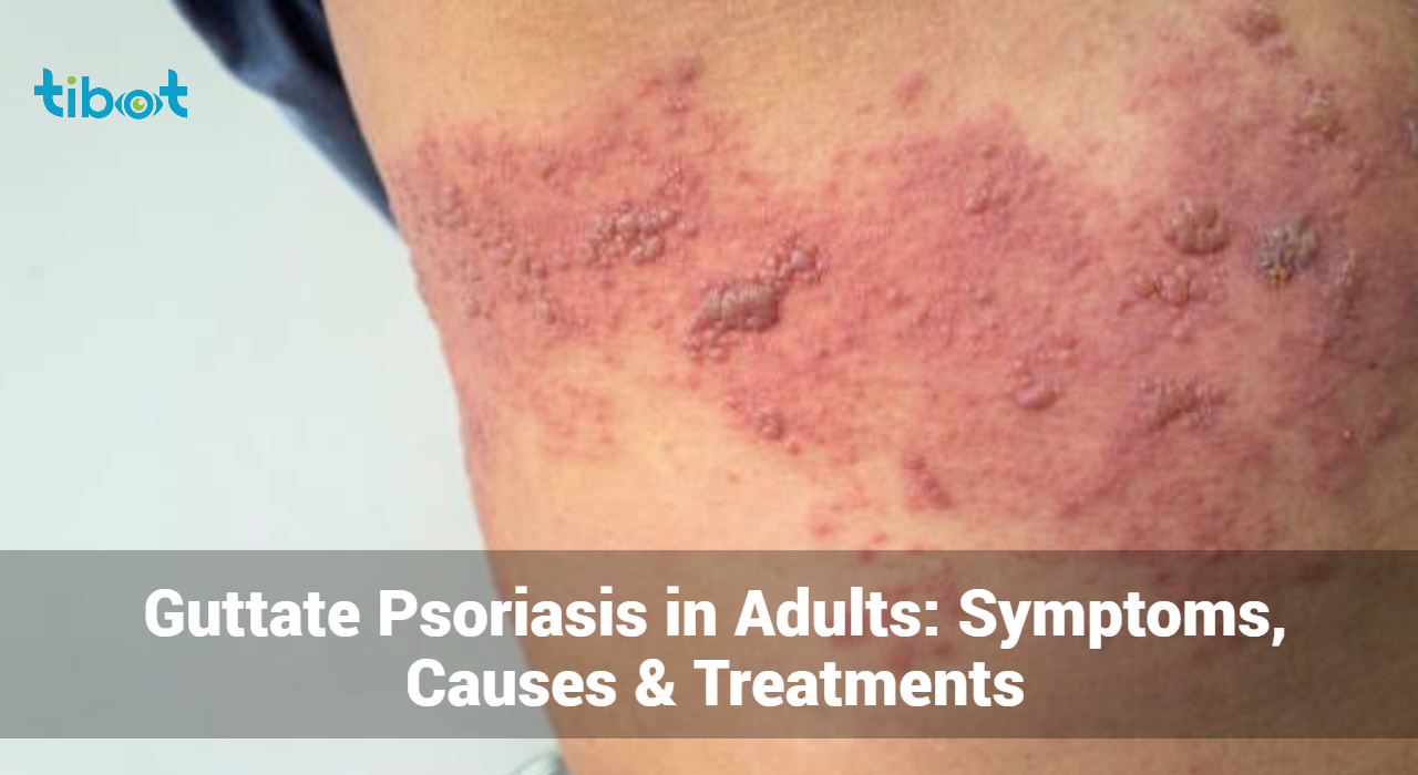 Guttate-Psoriasis-in-Adults