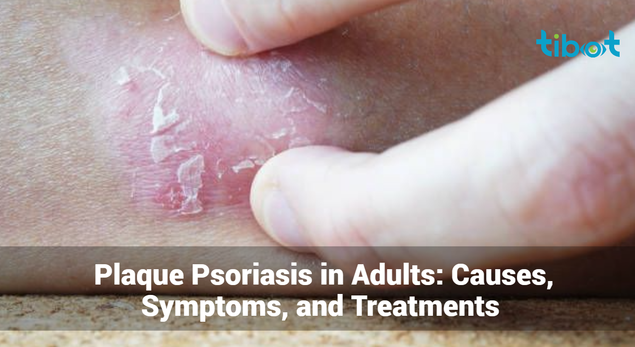 Plaque-Psoriasis-in-Adults