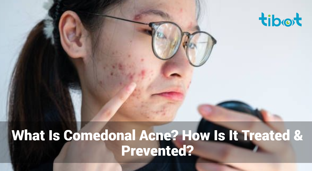 What-Is-Comedonal-Acne