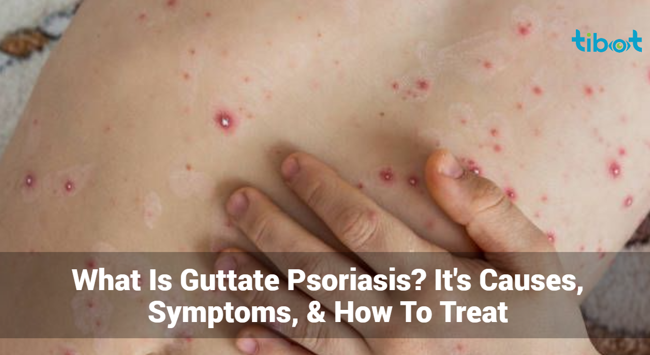 Guttate Psoriasis - Causes, Symptoms, And How To Treat